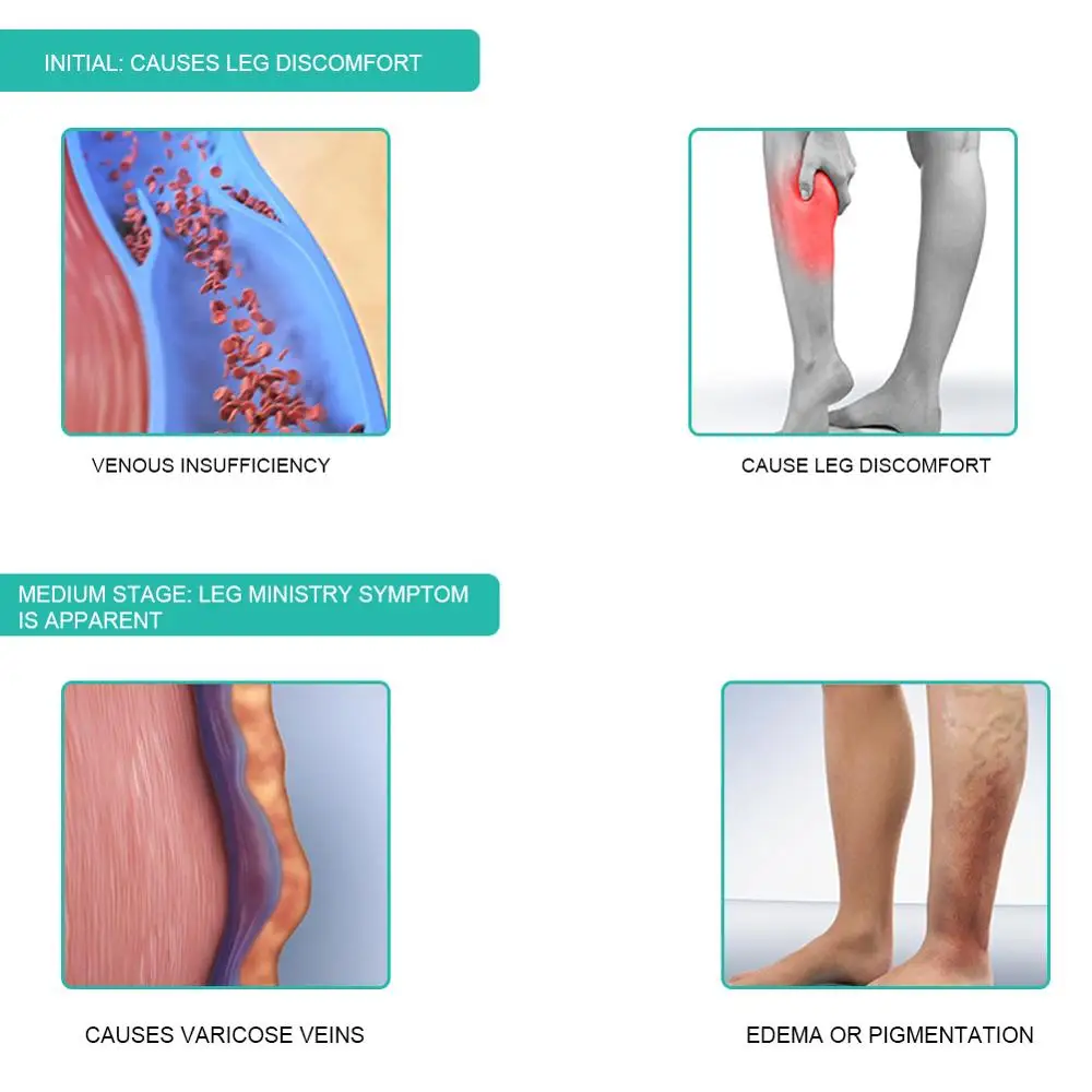 医療用着圧ソックス,1ペア,30-40mmhg,ふくらはぎス - Compression Sock Medical のレビューと価格