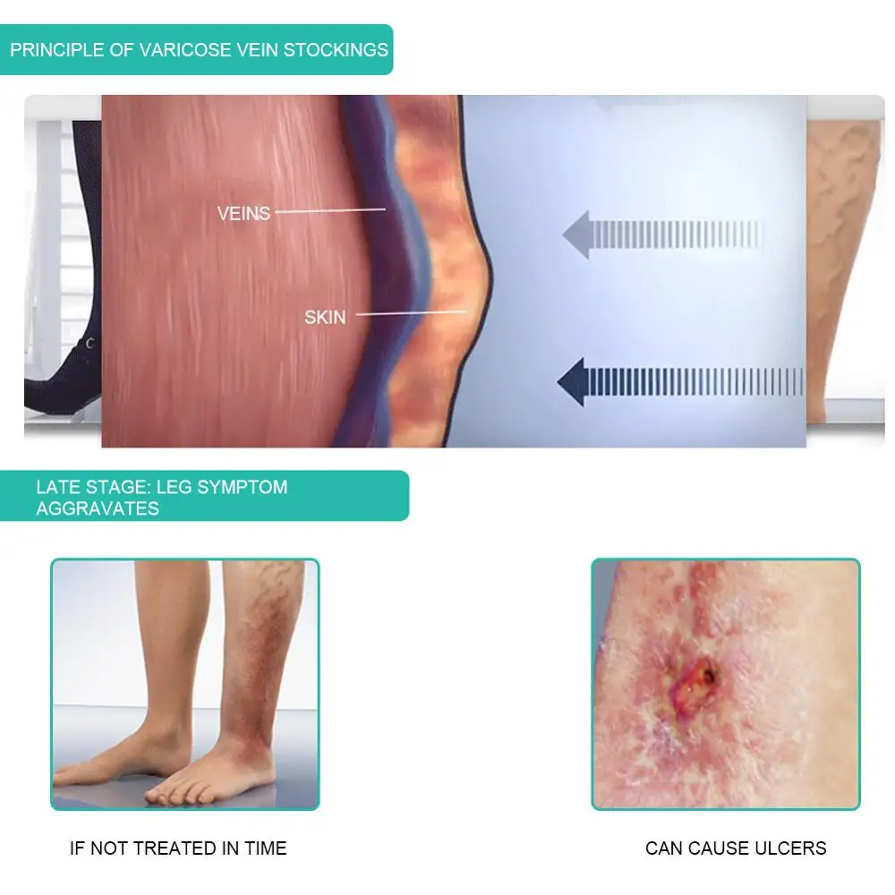 医療用着圧ソックス,1ペア,30-40mmhg,ふくらはぎス - Compression Sock Medical のレビューと価格