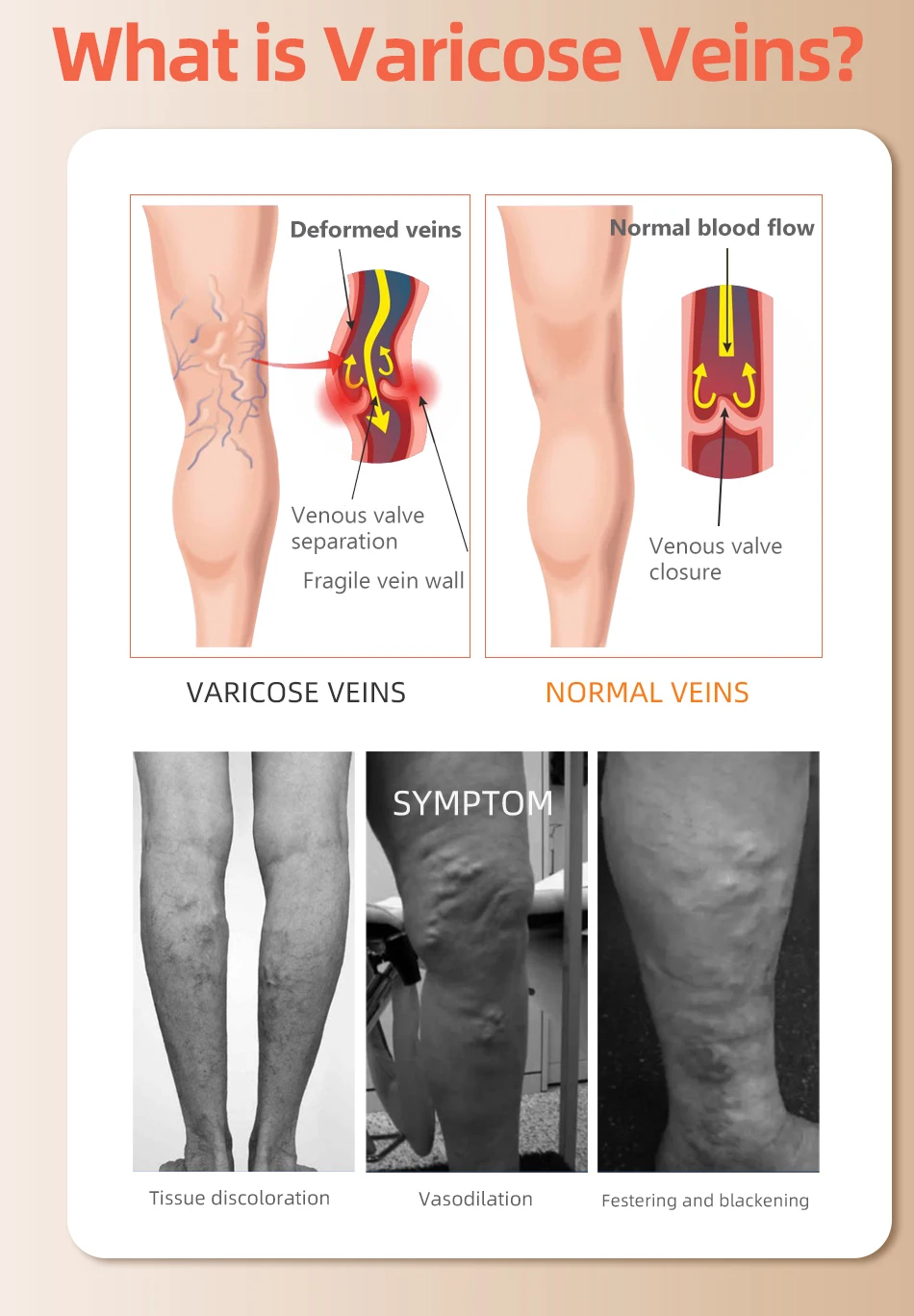 男性と女性のための閉じたつま先の静脈瘤ソックス、医療用太もも - Compression Sock Medical のレビューと価格